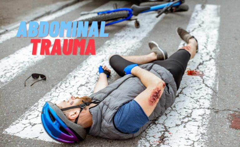 Abdominal Trauma